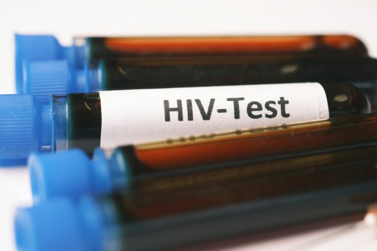 愛滋、愛滋病、人類免疫缺乏病毒（HIV，俗稱愛滋病毒）